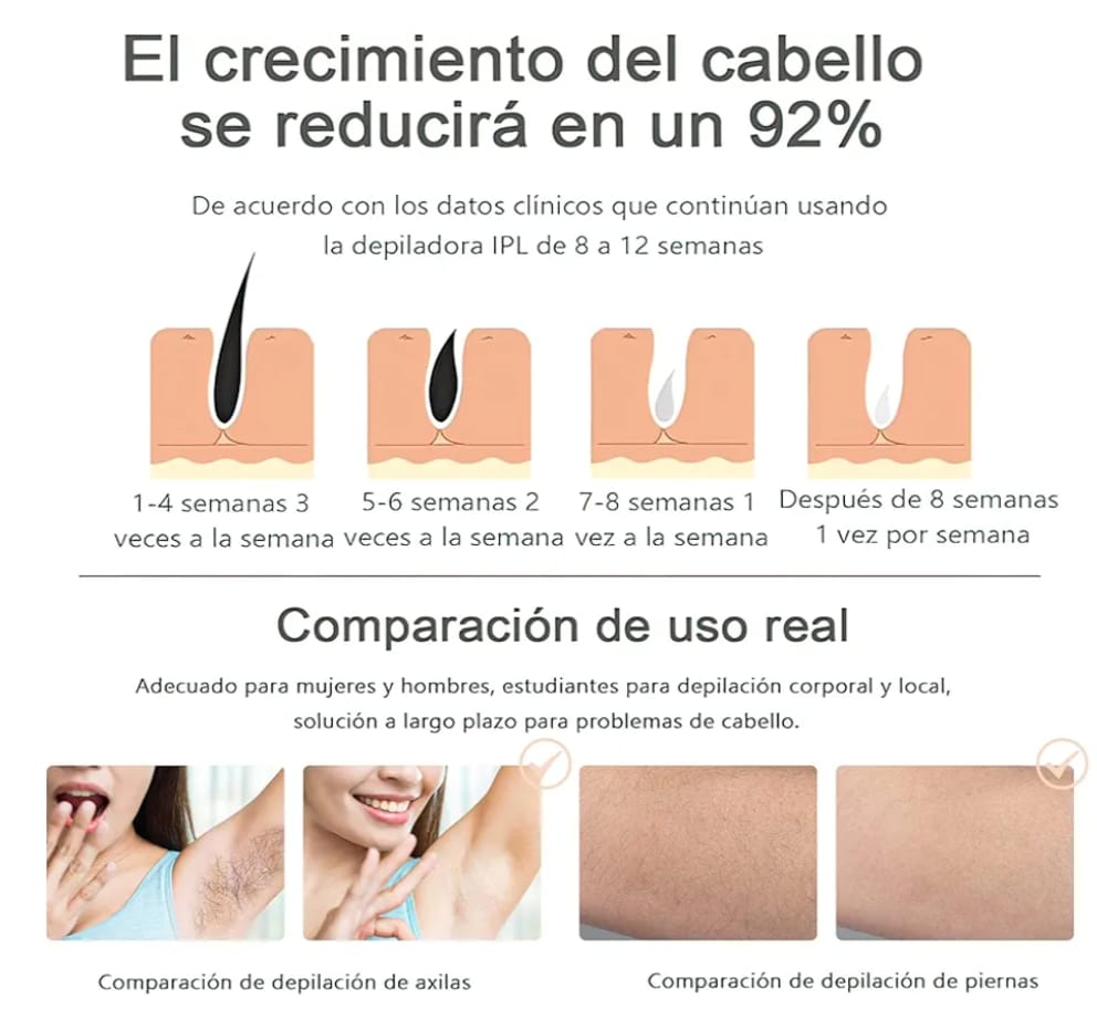 Depiladora Laser Ipl